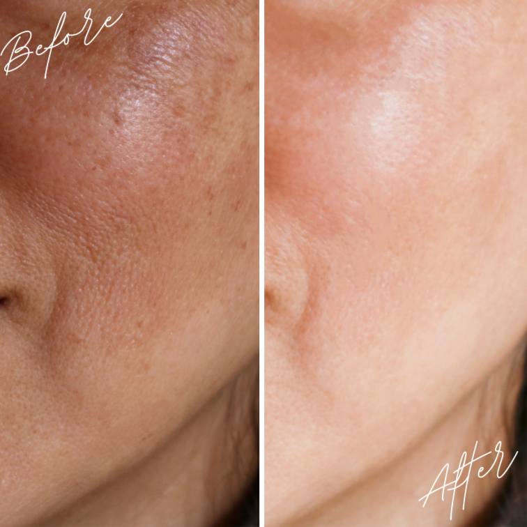 Eclat face oil is age and sunspot reversal oil, rich in antioxidants and vitamin C for youthful and spot-free skin.